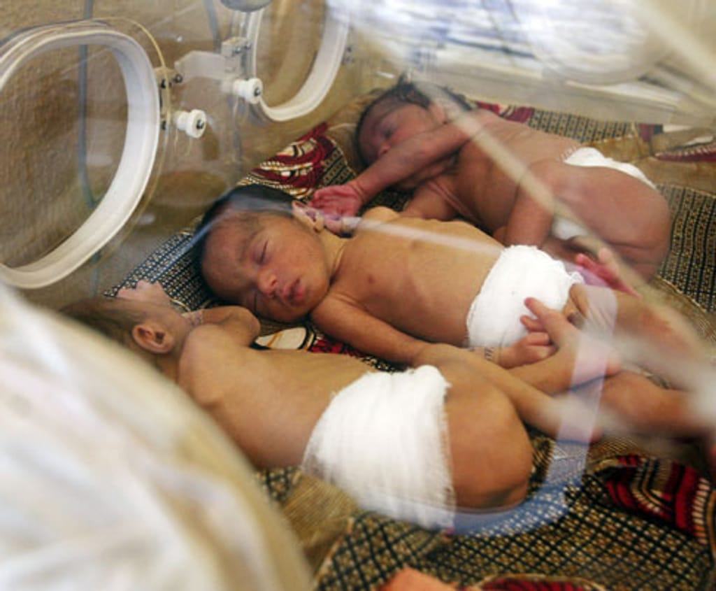 Hospital Central de Nampula realiza com sucesso quinto parto de trigémeos em 2026